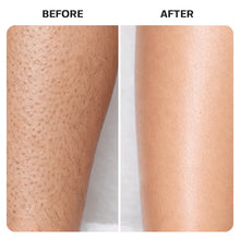 Load image into Gallery viewer, Razorburn/Ingrown Hair Roller Serum