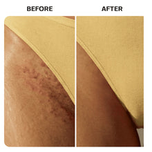 Load image into Gallery viewer, Razorburn/Ingrown Hair Roller Serum